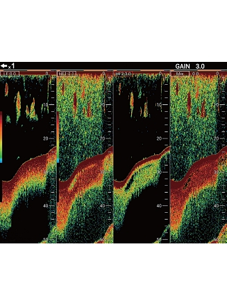 Simultaneous gain setting for increased visibility